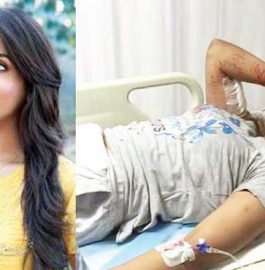 வெறிநாய்களிடம் மாட்டிக் கொண்ட தனுஷ் பட நாயகி… தலையைக் கடித்துக் குதறின!